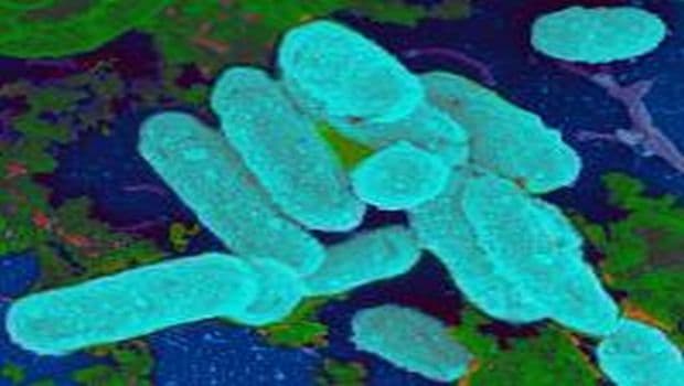 Scientist Finds Link Between Antibiotics, Bacterial Biofilms and Chronic Infections