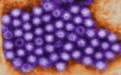 Collaboration Leads to Eradication of Norovirus Outbreak in a Pediatric Transplant Unit