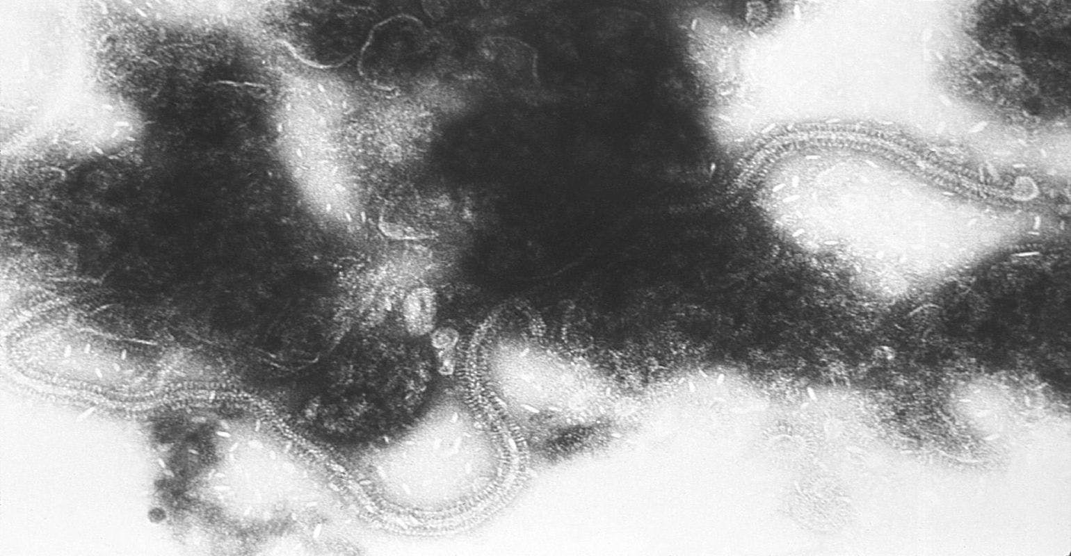 Respiratory Syncytial Virus under a microscope (Adobe Stock) 