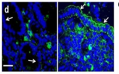 Study Identifies New Way to Treat Common HAI