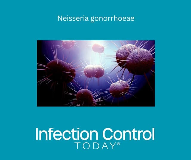 Neisseria gonorrhoeae  (Adobe Stock 248386948 by Design Cells)