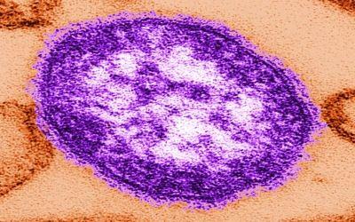 Measles Outbreak Underscores Need for Continued Vigilance in Healthcare Settings